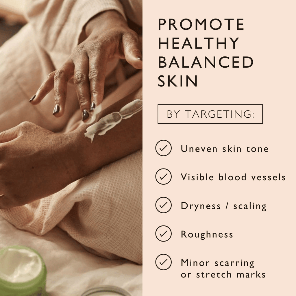 Natural Body Cream with Aloe Vera + Cocoa Butter — FREE SHIPPING!!! — product photo 4