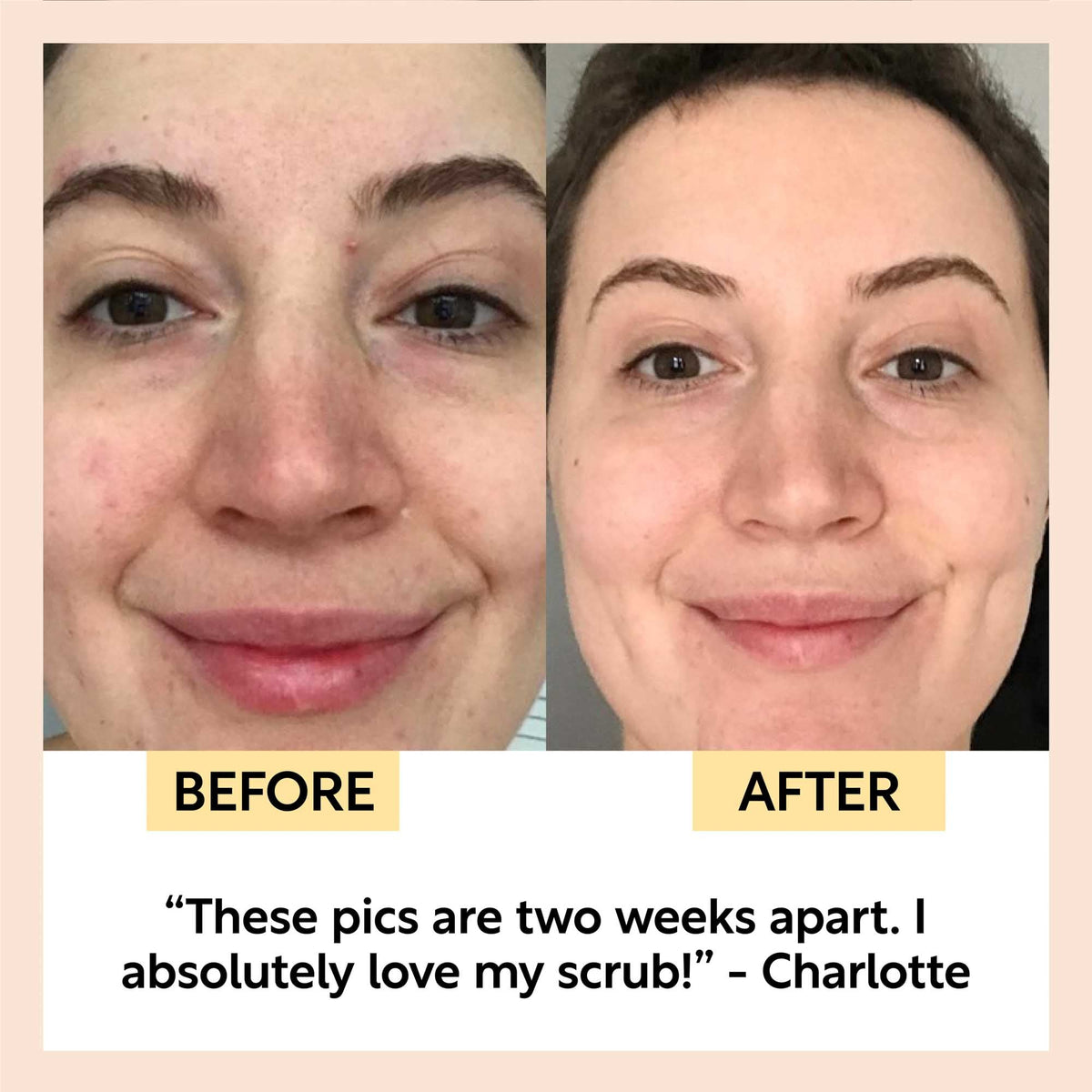 UpCircle Face Scrub with Coffee + Rosehip Oil — Citrus Blend