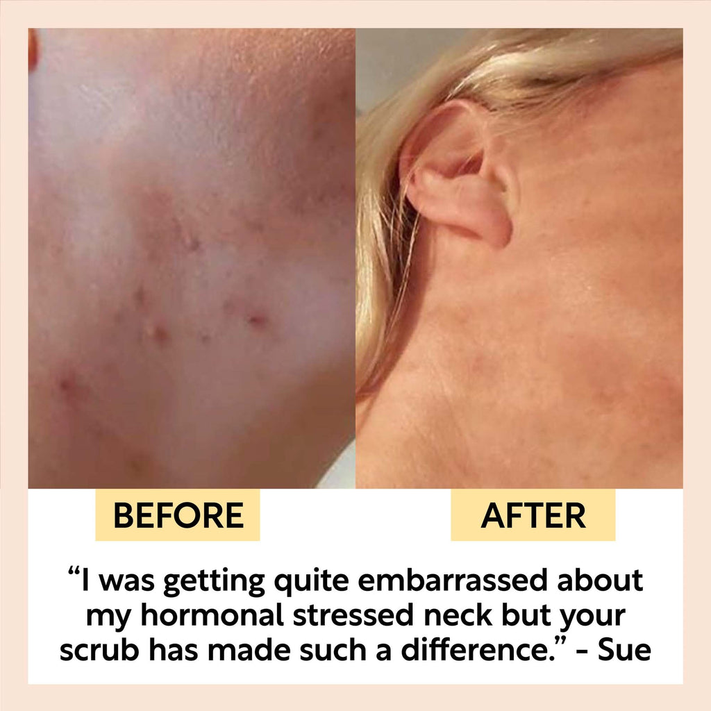 UpCircle Face Scrub with Coffee + Rosehip Oil — Citrus Blend