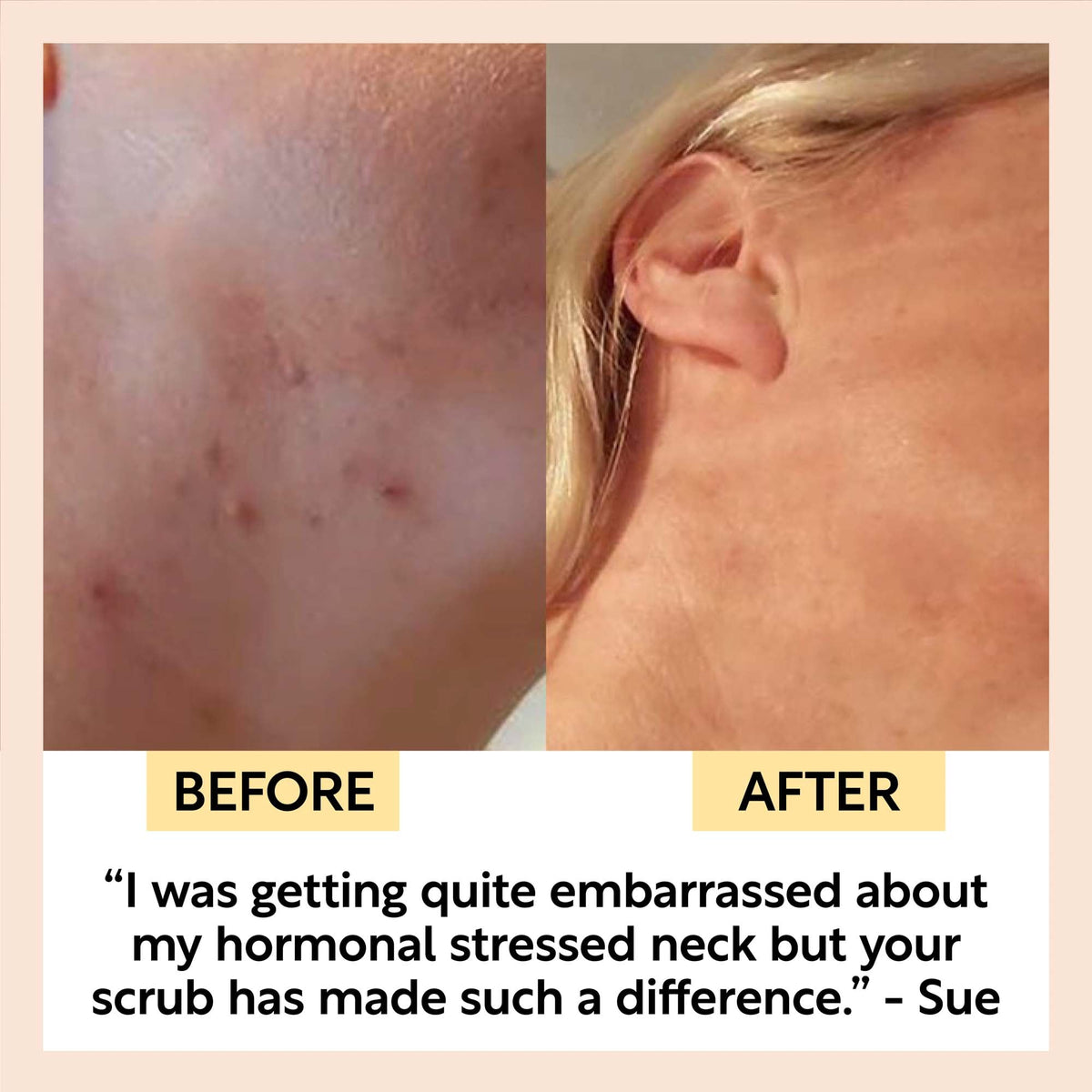 UpCircle Face Scrub with Coffee + Rosehip Oil — Citrus Blend