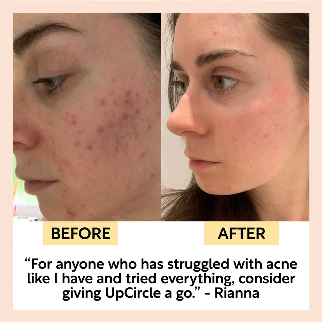 UpCircle Face Toner with Hyaluronic Acid