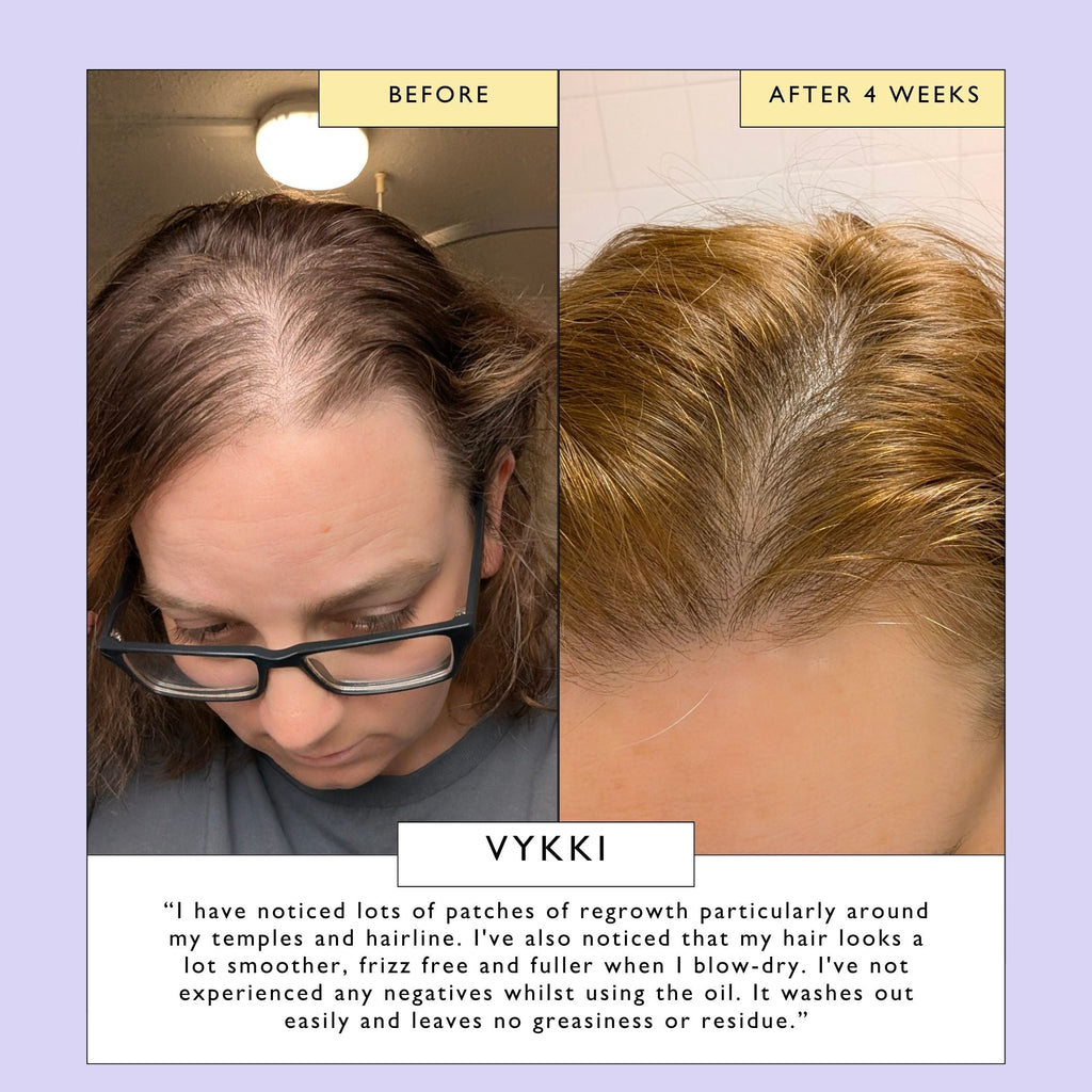 UpCircle Scalp + Hair Oil with Bacuri Butter + Castor Oil