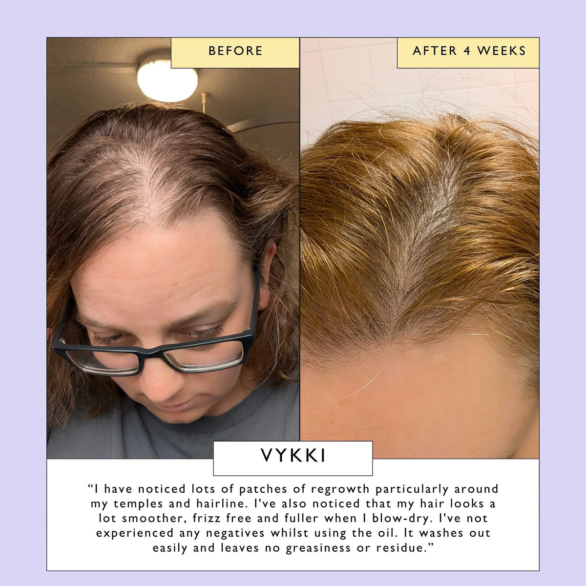 UpCircle Scalp + Hair Oil with Bacuri Butter + Castor Oil