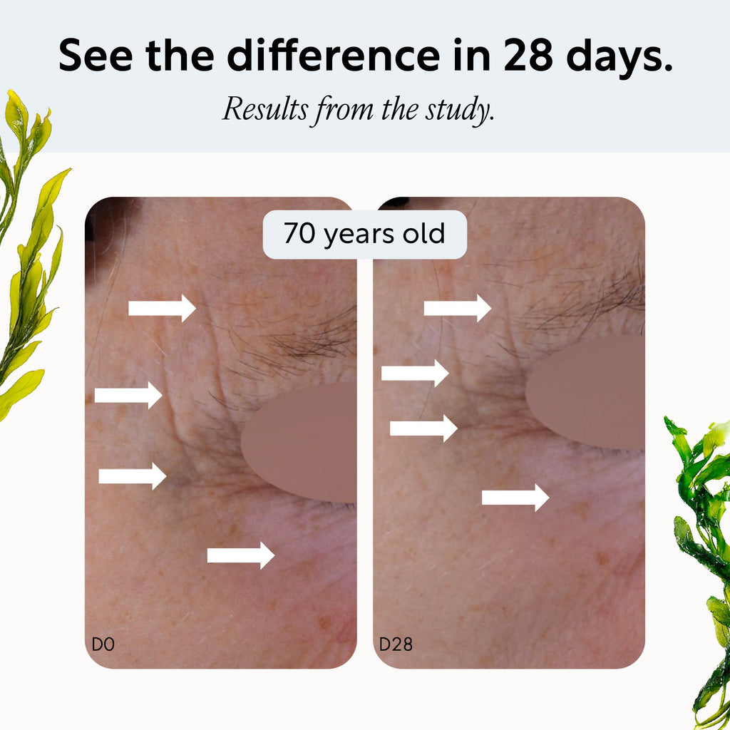 UpCircle Overnight Eye Treatment with Retinol Exosomes